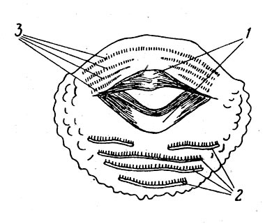 Рис. 13. Рот головастика Rana temрoraria. 1 — клювик;   2 — серии нижнегубных зубов; 3 — серии верхнегубных зубов.