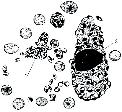 Рис. 60. Возбудитель кожного лейшманиоза (пендинской язвы) Leishmania tropica: 1 - группа паразитов, выпавшая из клеток хозяина; 2 - клетка с многочисленными паразитами
