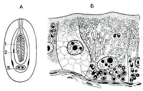 Рис. 84. Микроспоридии рода Nosema: А - строение споры Nosema bombycis; Б - срез через эпителий кишечника шелковичного червя, набитого шизонтами и спорами. 1 - стрекательная капсула; 2 - нить стрекательной капсулы; 3 - амебоид с ядрами