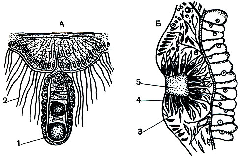Рис. 143. Органы чувств гидромедуз: А - статоцист медузы кунина (Cunina); (по О. и Р. Гертвигам); Б - глазок медузы Корине (Corine) (по Линко). 1 - статолит; 2 - чувствительные волоски; 3 - светочувствительные клетки; 4 - пигментные клетки; 5 - хрусталик