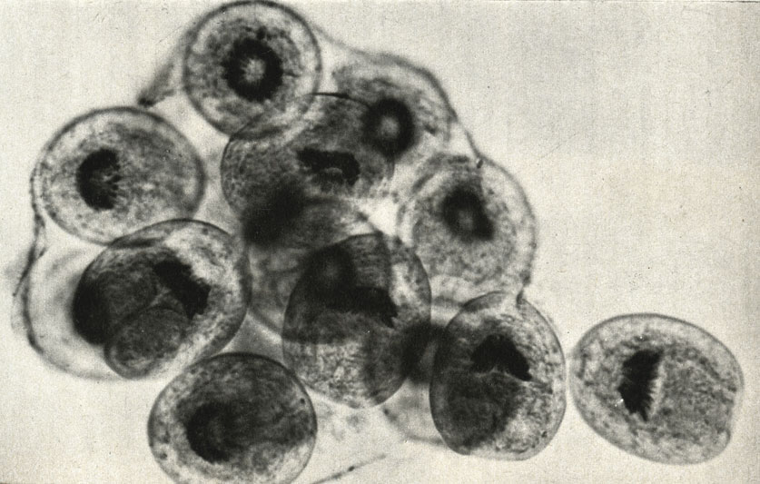    (Echinococcus granulosus)