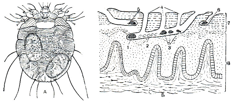 Рис. 62. Чесоточные клещи: А - чесоточный зудень (Acarus siro), самка; Б - схема расположения в коже маточного хода (в середине), хода самца (справа) и хода телеонимфы (слева) чесоточных клещей рода Acarus; 1 - самка; 2 - яйца; 3 - личинки и нимфы; 4 - вентиляционные отверстия; 5 - оплодотворенная телеонимфа; 6 - самец; 7 - роговой слой кожи; 8 - живые клеточные слои кожи