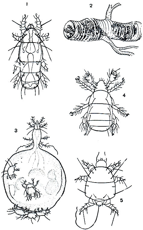 Рис. 64. Клещи-тарсонемиды: 1 - вредитель злаков Siteroptes graminum; 2 - трахея пчелы, больной акарозом, внутри клещи Acarapis woodi; 3 - пузатый клещ (Pyemotes ventricosus), беременная самка с раздутым брюшком, на котором держатся самцы; 4 - паразит грызунов Pygmephorus forcipatus; 5 - Locustacarus trachealis, живущий в трахеях саранчи, личинкоподобная самка