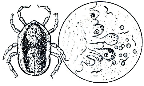 Рис. 79. Аргасовый клещ Ornithodoros papillipes: справа - спирохеты клещевого возвратного тифа в просвете кишечника и в клетках кишечного эпителия аргасового клеща при большом увеличении микроскопа