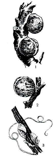 Рис. 215. Ложнощитовки и подушечницы (самки): 1 - яблоневая ложнощитовка (Eulecanium bituberculatum); 2 - дубовый кермес (Kermes variegatus); 3 - виноградная подушечница (Pulvinaria vitis)